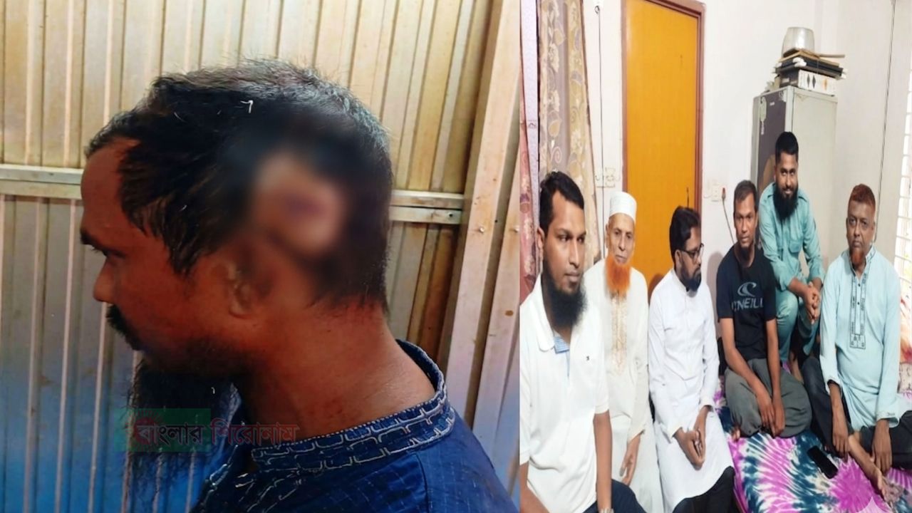 সরকারি সম্পদ রক্ষা করতে গিয়ে রক্তাক্ত রেলকর্মী আলীমুজ্জামান, কর্তৃপক্ষের নেই কোনো খোঁজ!