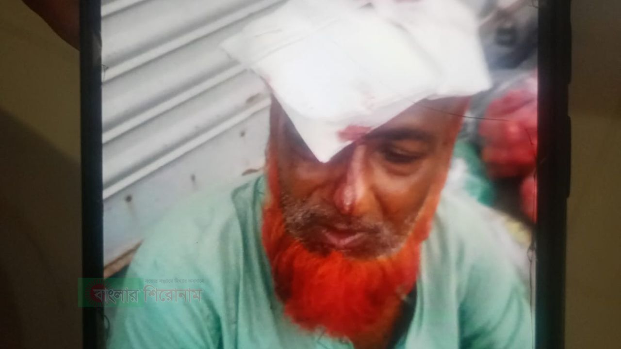 ফতুল্লায় শিক্ষকের বাড়িতে দুর্ধষ ডাকাতি, বৃদ্ধ বাবার মাথায় কুপিয়ে স্বর্নালংকার টাকা লুট
