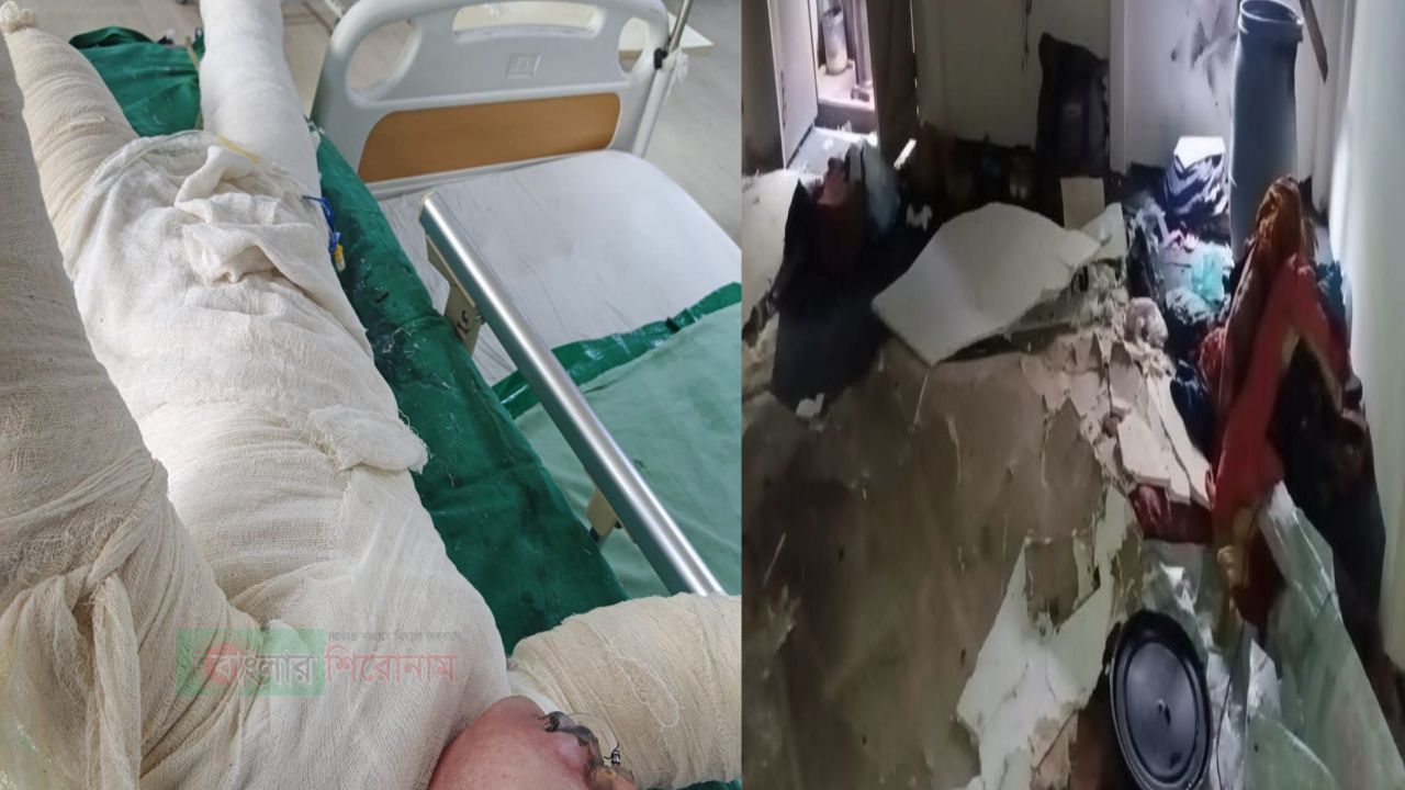 নারায়ণগঞ্জে গ্যাস লিকেজ থেকে অগ্নিকাণ্ড: শিশুসহ একই পরিবারের তিনজন দগ্ধ  ​