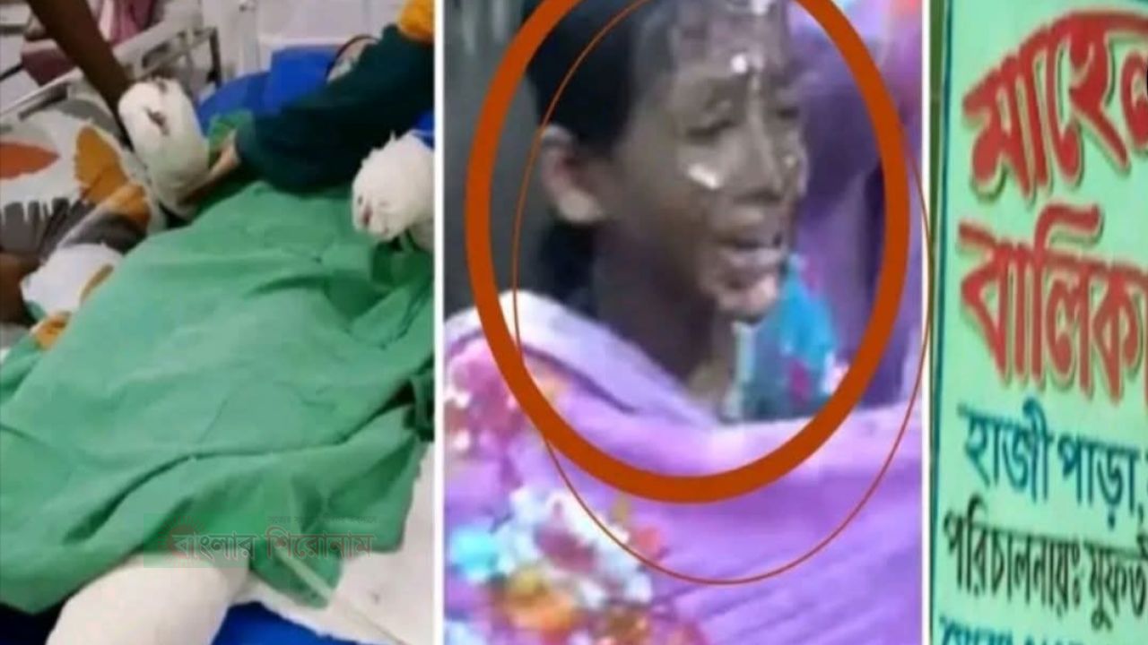 মাহেলা খাতুন মাদ্রাসায় বিদ্যুৎস্পৃষ্ট: আইসিইউতে থাকা আতিয়ার মৃত্যু
